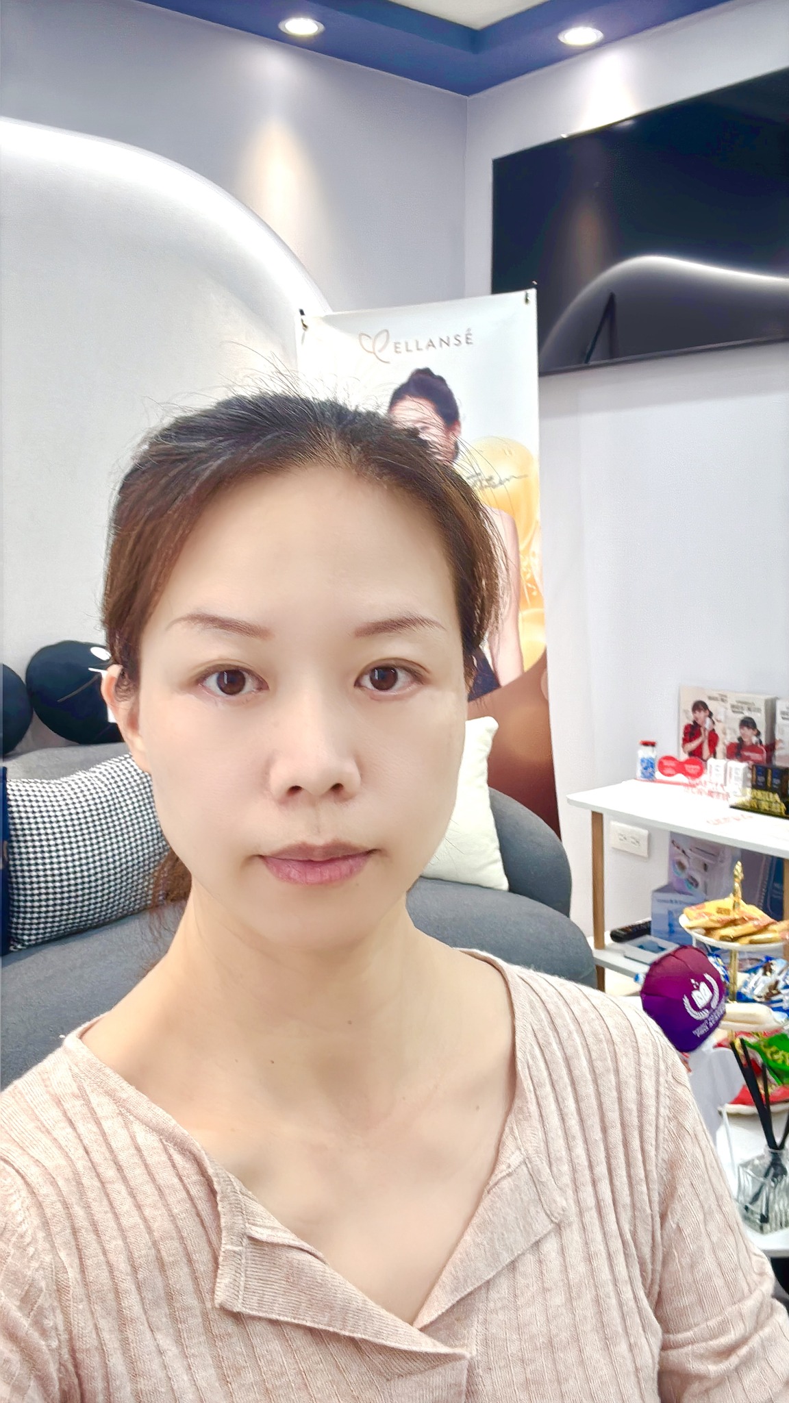 板橋四維皮膚科診所X星和醫美聯盟-皮秒雷射