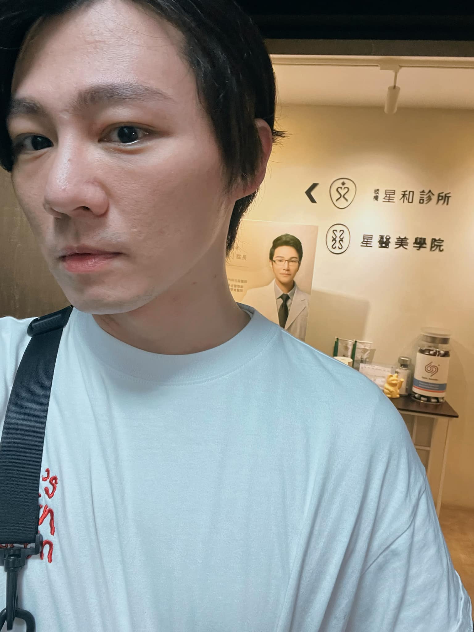板橋星和診所-杏仁酸煥膚