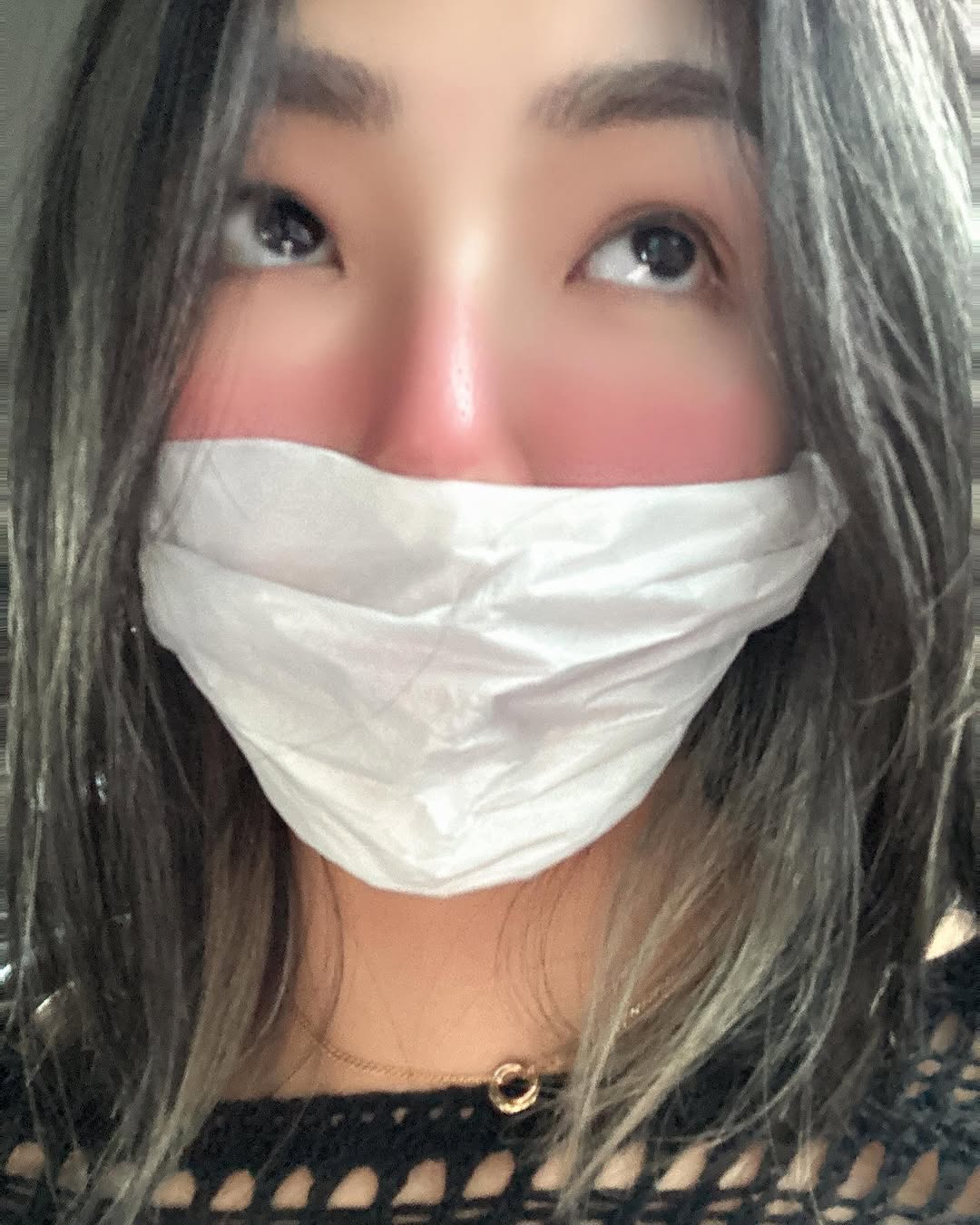 板橋四維皮膚科診所-皮秒雷射