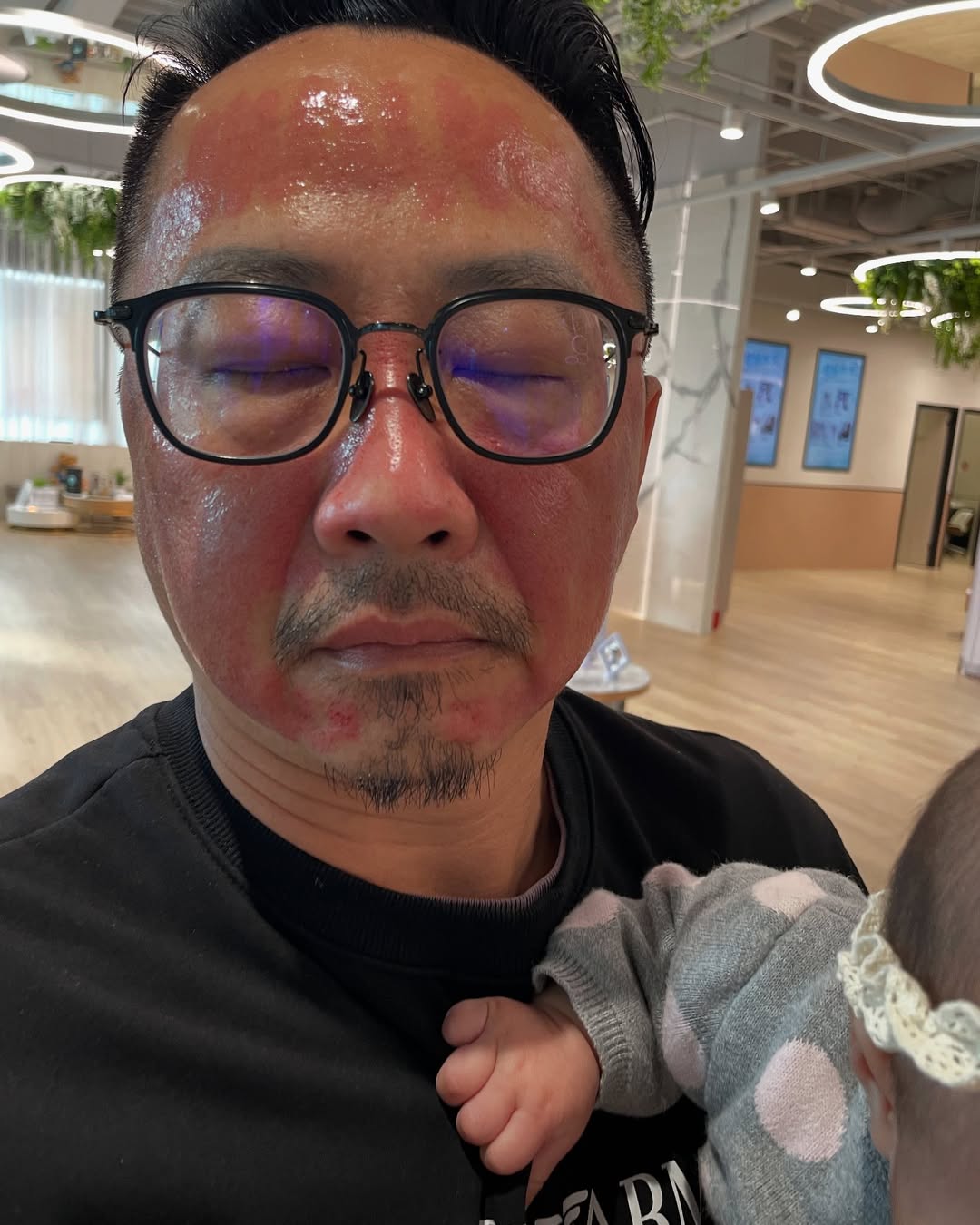 站前星和診所-皮秒雷射