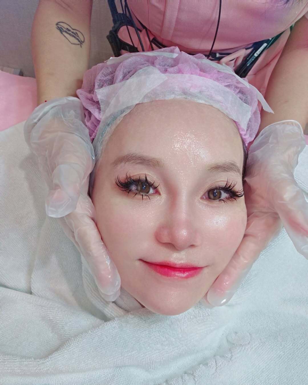 星和仁愛診所-杏仁酸煥膚