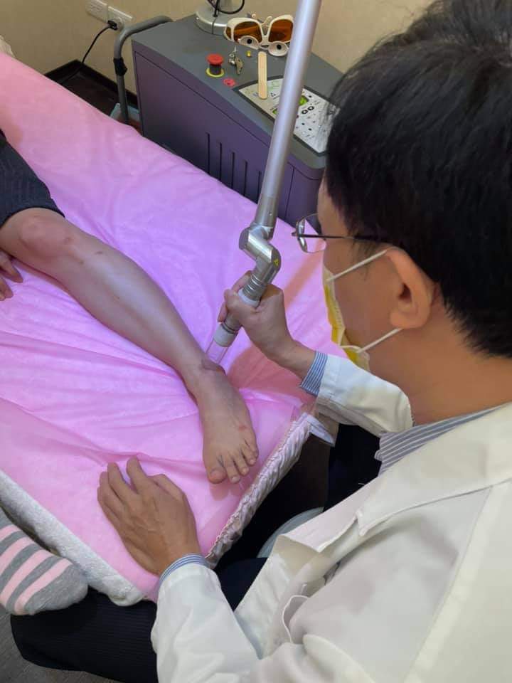 【櫻花雷射/染料雷射】天氣比女人還善變，猛冒痘痘留下討厭的痘疤，跑來打櫻花雷射整個改善超多 ！！！-艾妮可Guten Appetit 美味人生