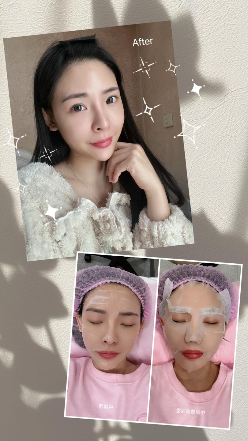 每個月去仁愛星和診所保養真的讓我的皮膚越來越好了！