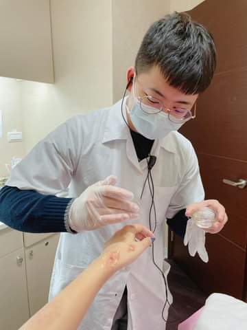 【淨膚雷射】 看我傷痕累累的手 我有信心半年內可以回到原廠設定！！~-劉瑄Vivia