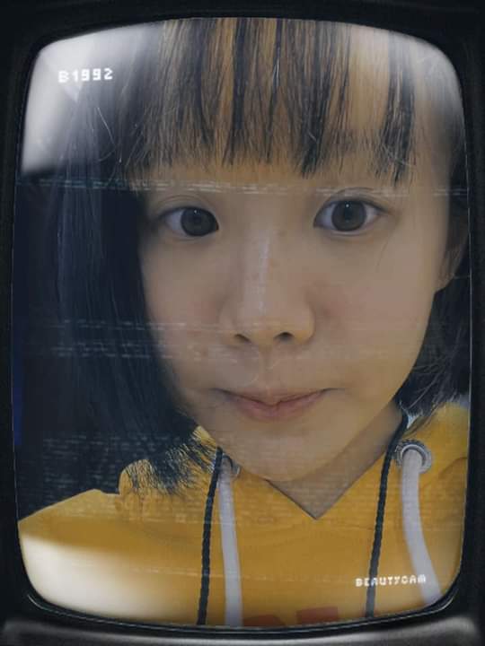 【杏仁酸煥膚】使用杏仁酸，加強代謝深層的痘痘！！！❤❤ ~-LOIS.C 陳洛