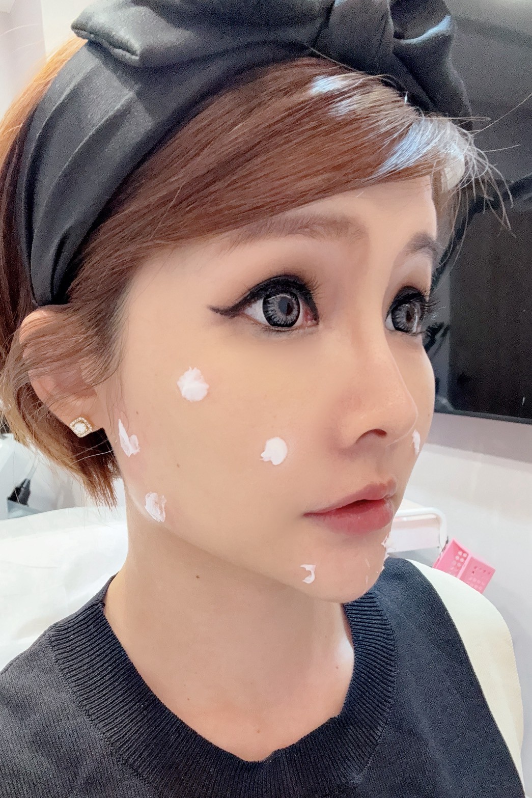 專門對付皮膚鬆弛、失去彈性的問題！【Profhilo逆時針】以單邊五點施打在臉上自然跟我們自己的玻尿酸融合