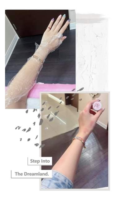 【淨膚雷射】星和診所/台北醫美-來打第三次淨膚雷射惹～拯救我半年前出車禍咪咪冒冒的手！！！~-劉瑄Vivia