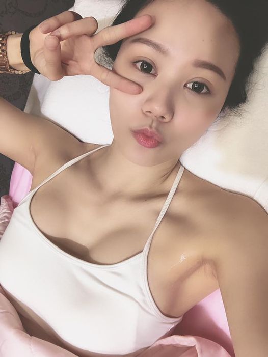 【雷射除毛】腋下乾乾淨淨是必須的
