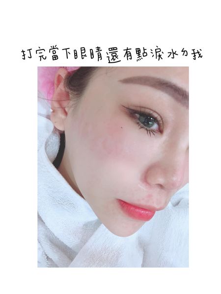 【皮秒雷射】開始會很期待自己卸妝後的膚質