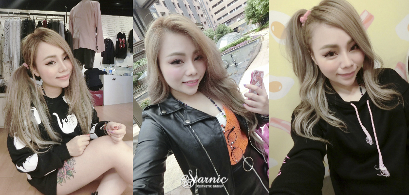 星和台南_肉毒瘦小臉_阿貓兒07