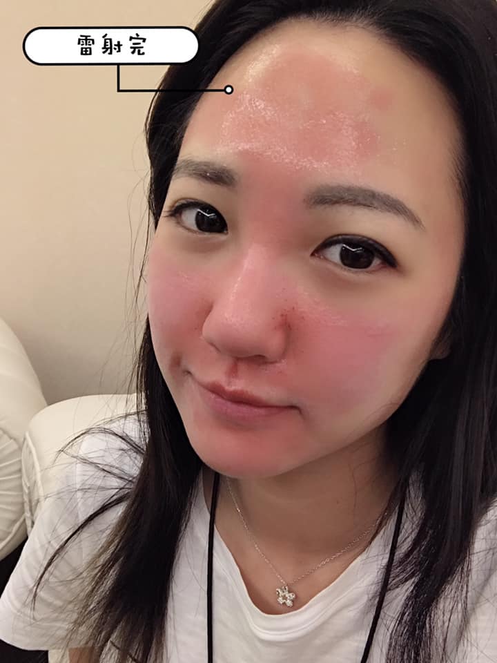 【皮秒雷射】星和診所-台南市 周顥洋醫師-完全光亮又不脫粉，這才是我心中的韓妹皮膚啊?_林苡