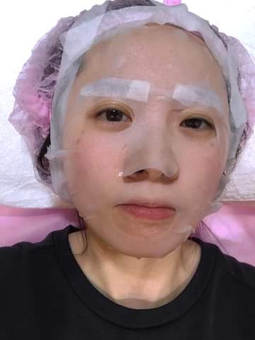  【皮秒雷射】仁愛星和診所/東區醫美-不必擔心術後的保養 也讓我愛上掉入醫美坑了❤️-小湯圓小珍珠の生活日常