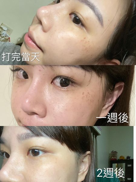 【彩衝光】這次效果因為真的太明顯所以來燒大家一下