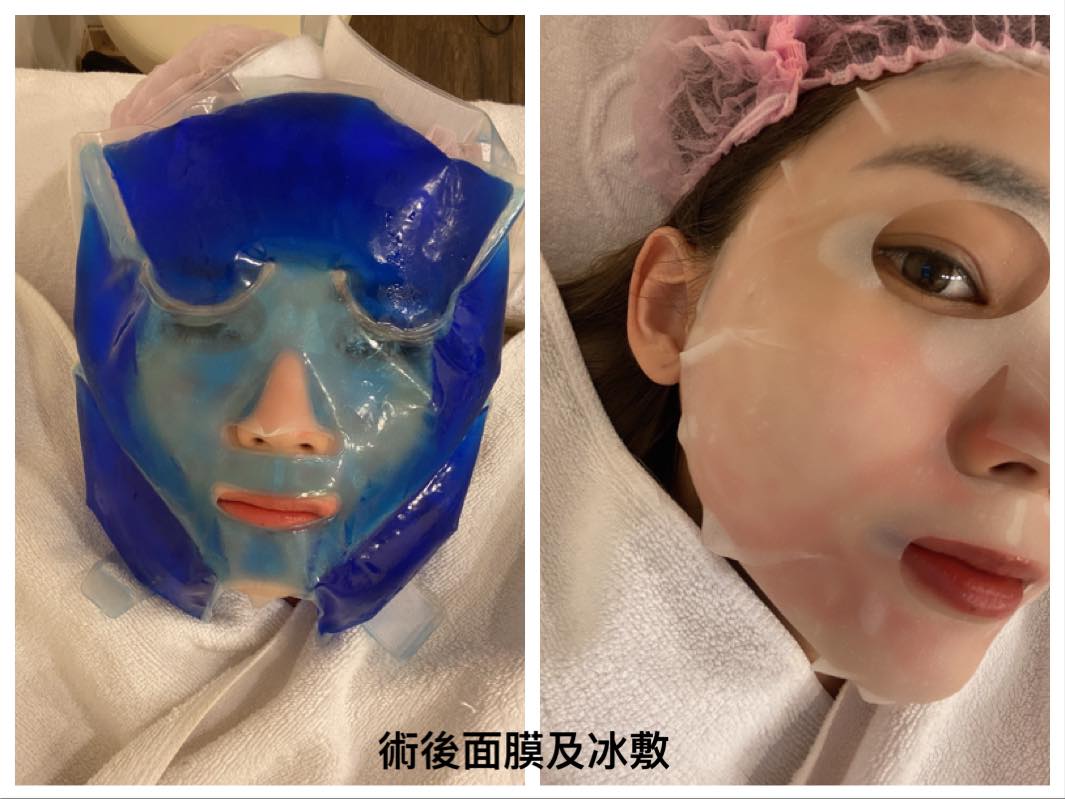 【皮秒雷射】星和診所（新竹市）-薛博今 醫師-皮秒讓運動不用上妝、臉臉自動發光-FanR樊兒