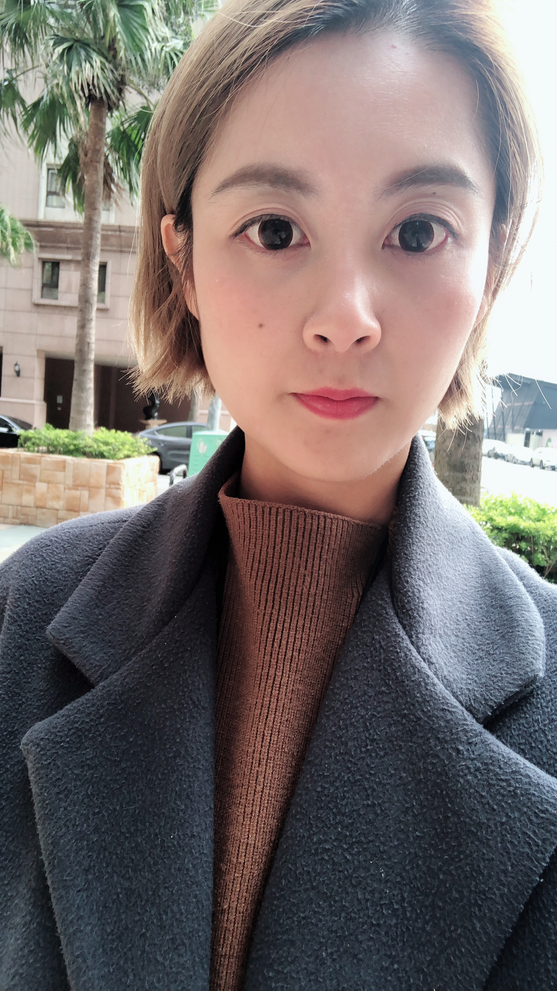 【天使瘦小臉注射】星和診所（新竹市）-薛傅今院長-還我左右對稱漂漂尖尖臉-法鬥兔星球