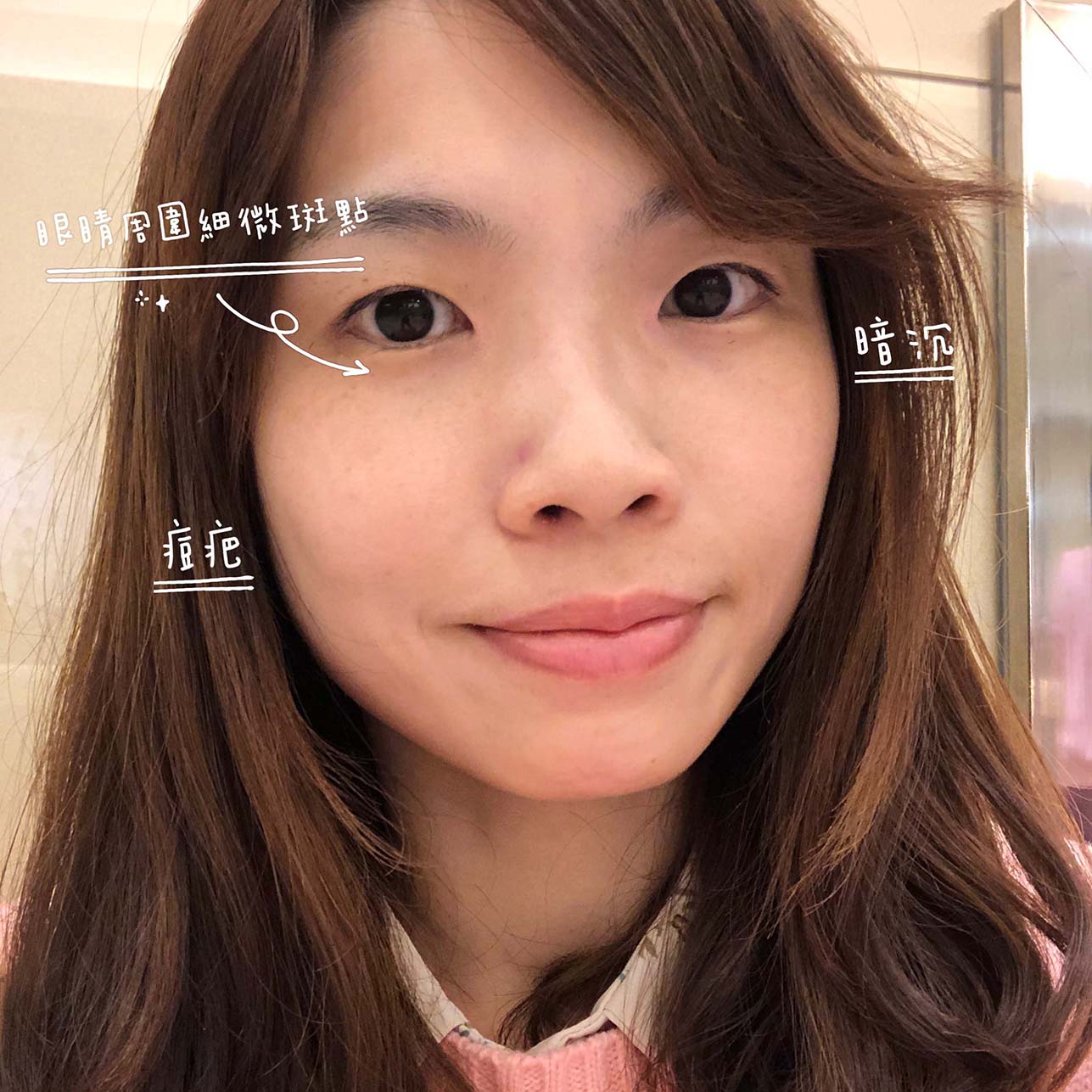 【皮秒雷射】星采整形外科診所(大安)-來聊聊這幾次皮秒後的心得！_Fan Fan 美好生活
