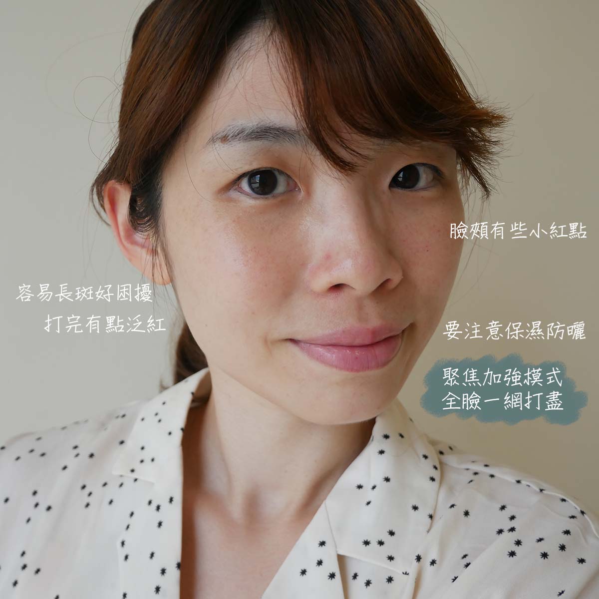 【皮秒雷射】台北星和診所-520❤️曾是我們的蜜月旅行飛出國的日子！_Fan Fan 美好生活