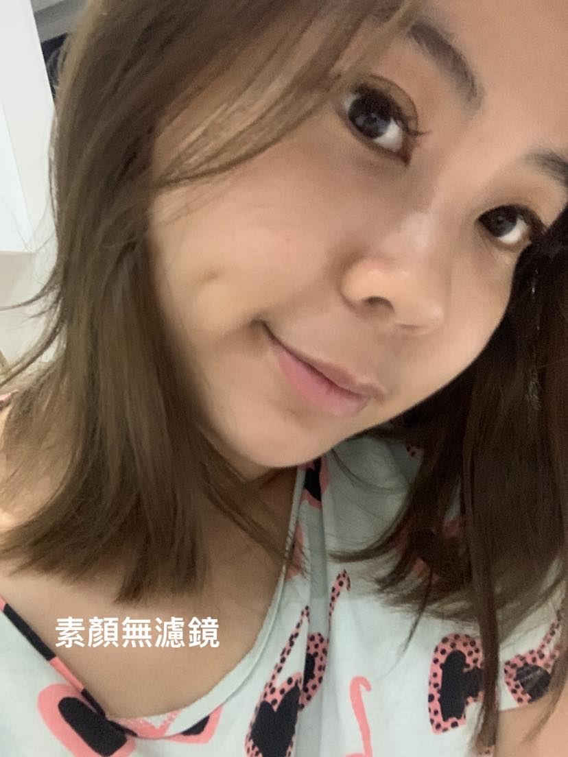 推薦皮秒雷射給👇 ✔️想治療斑點卻怕反黑的人 ✔️想短時間改善膚質的人 ✔️想改善肌膚粗糙、毛孔粗大的人 術後記得要多注意防曬跟保濕!才能完美結束這回合✌🏻
