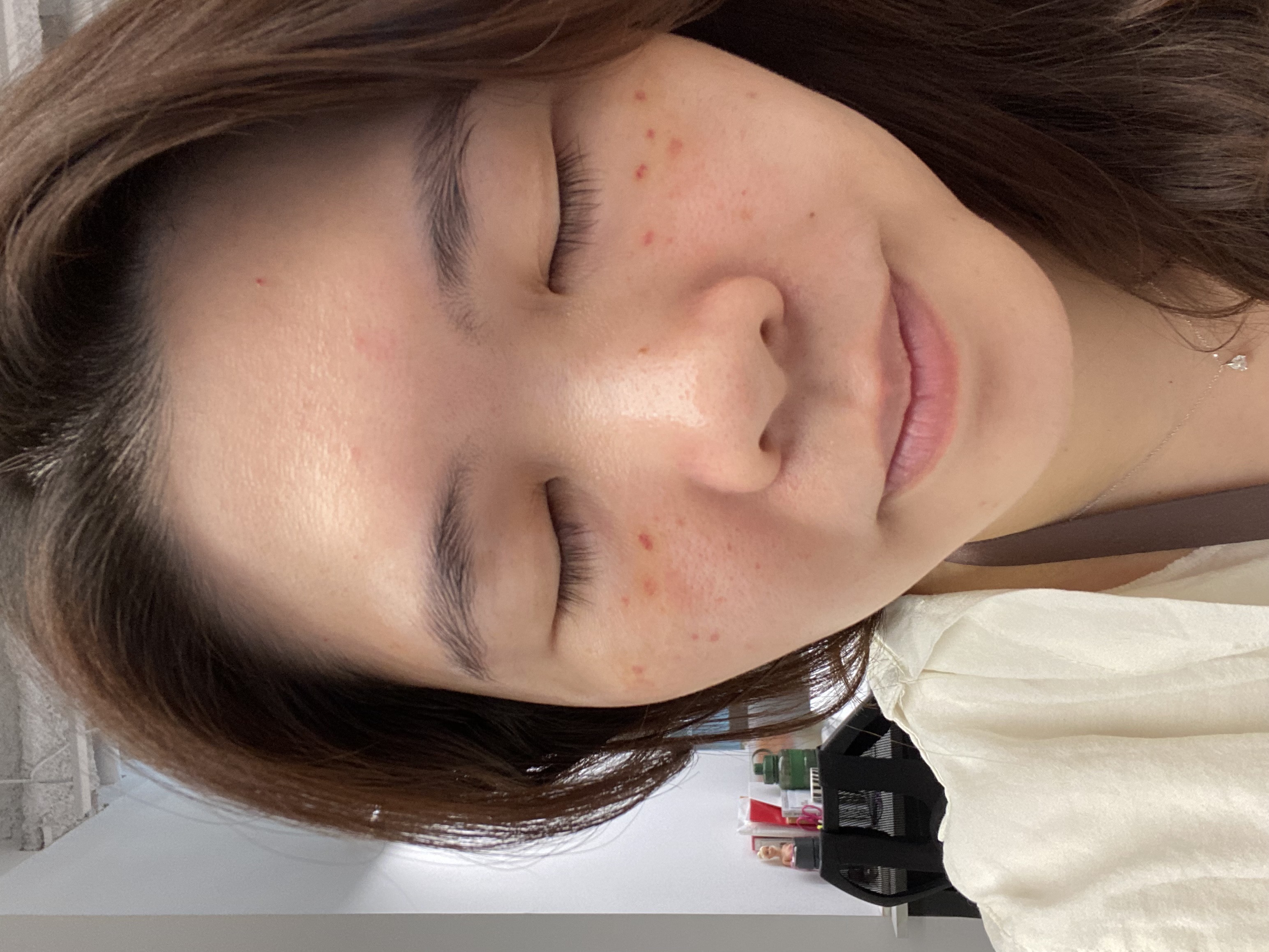 星和診所（台北）-修秘水光