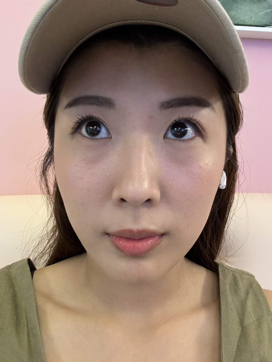 星和診所（台北）-修秘水光