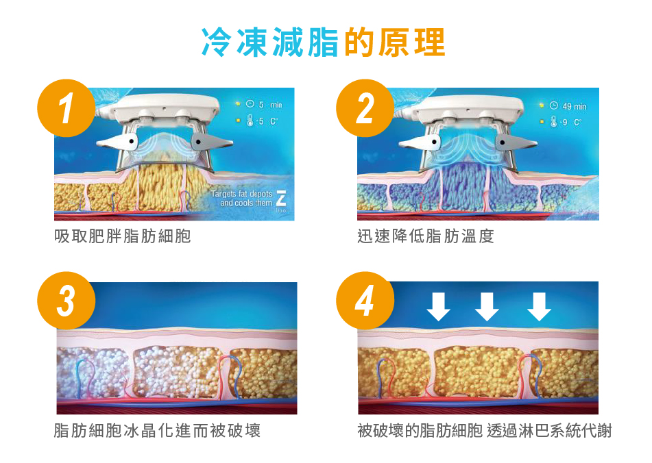 Z塑酷瘦掰掰袖