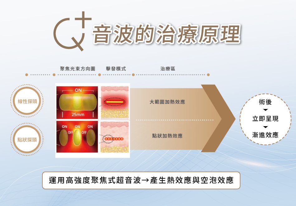音波幫助緊緻、拉提皮膚！和電波拉皮差在哪？醫師解答：符合「這關鍵」更重要