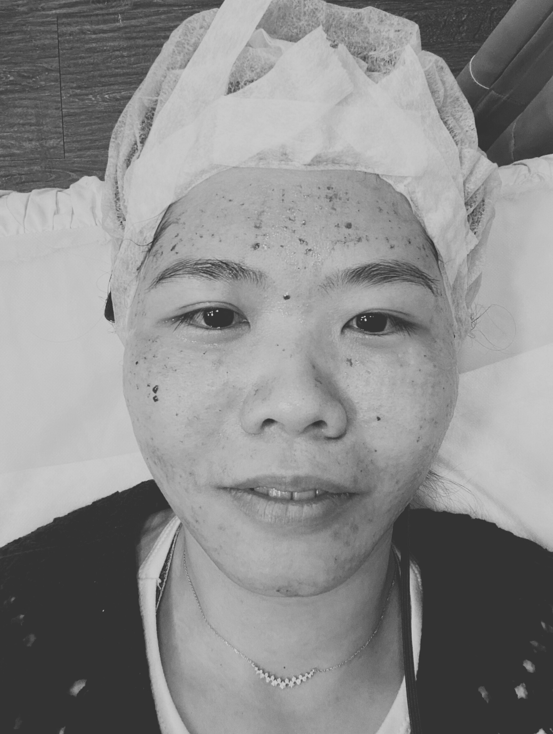 星和診所（台北）-修秘水光