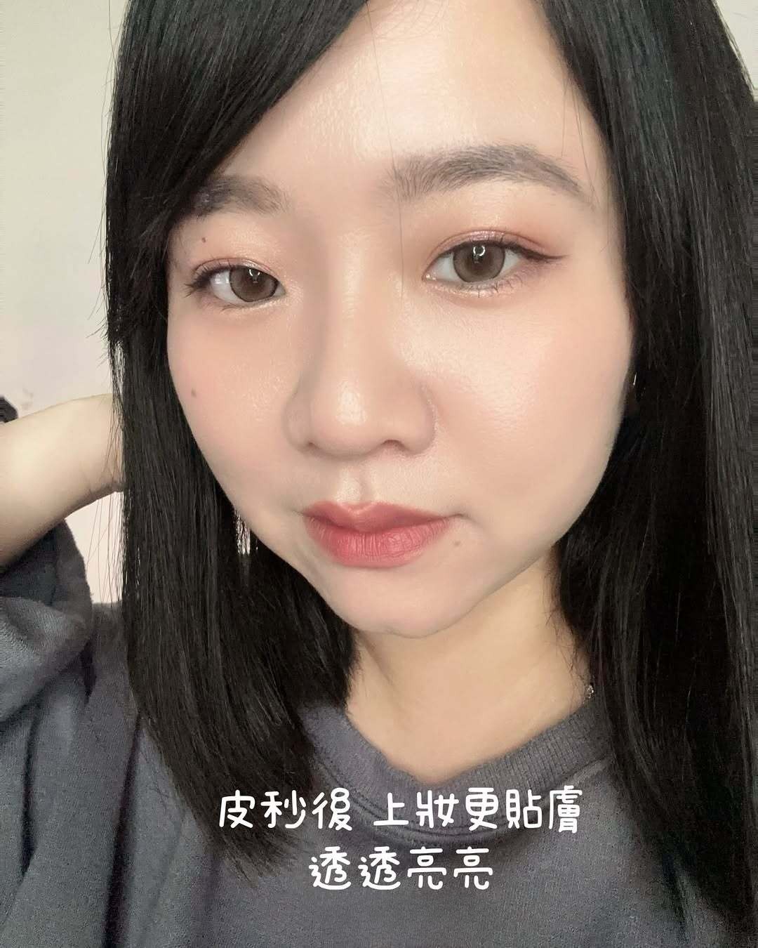 星和診所（高雄）-皮秒雷射
