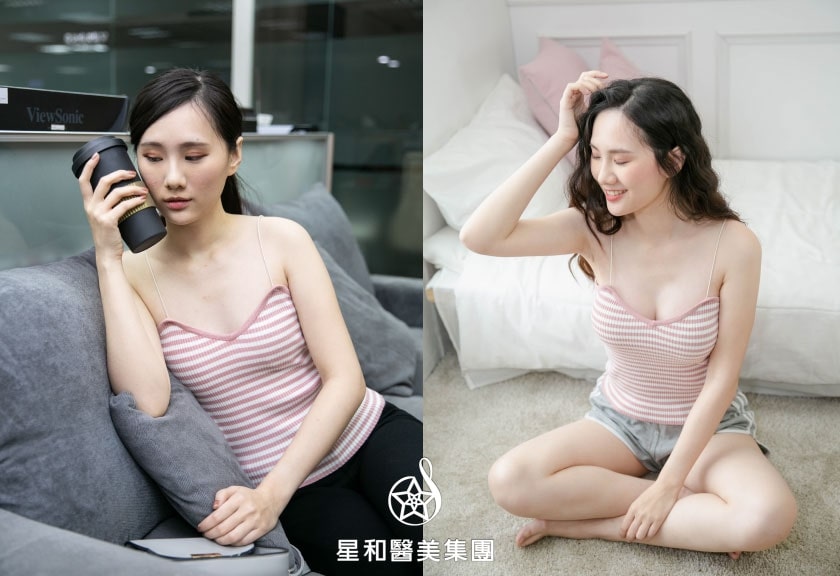 隆乳案例分享