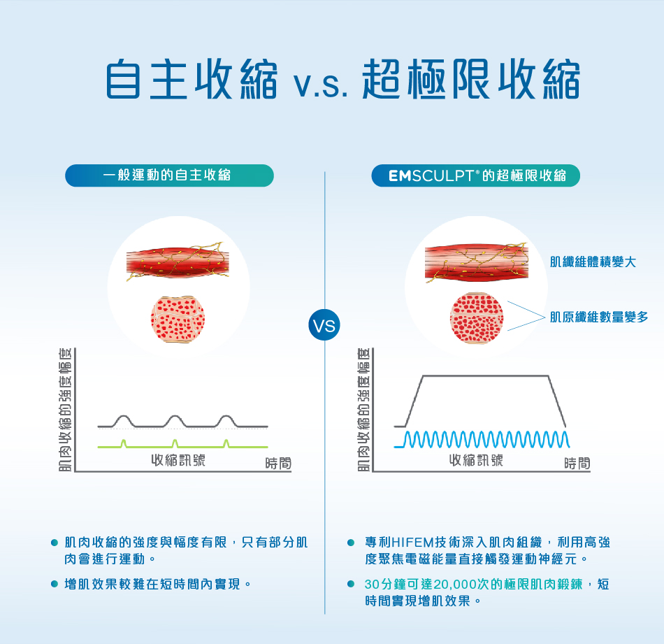 Emsculpt療程原理：透過電磁觸發肌肉的超極限收縮