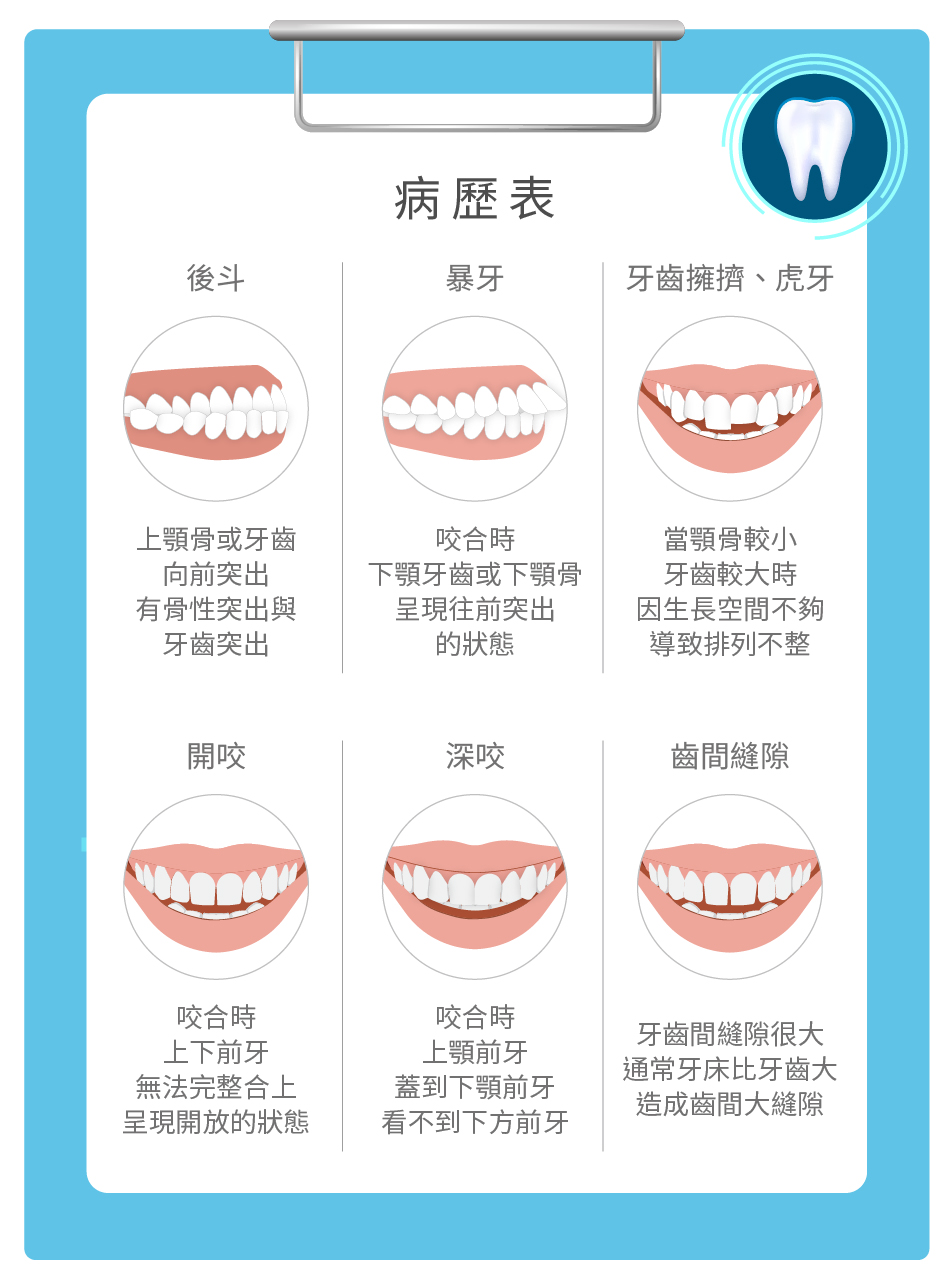 咬合不正類型