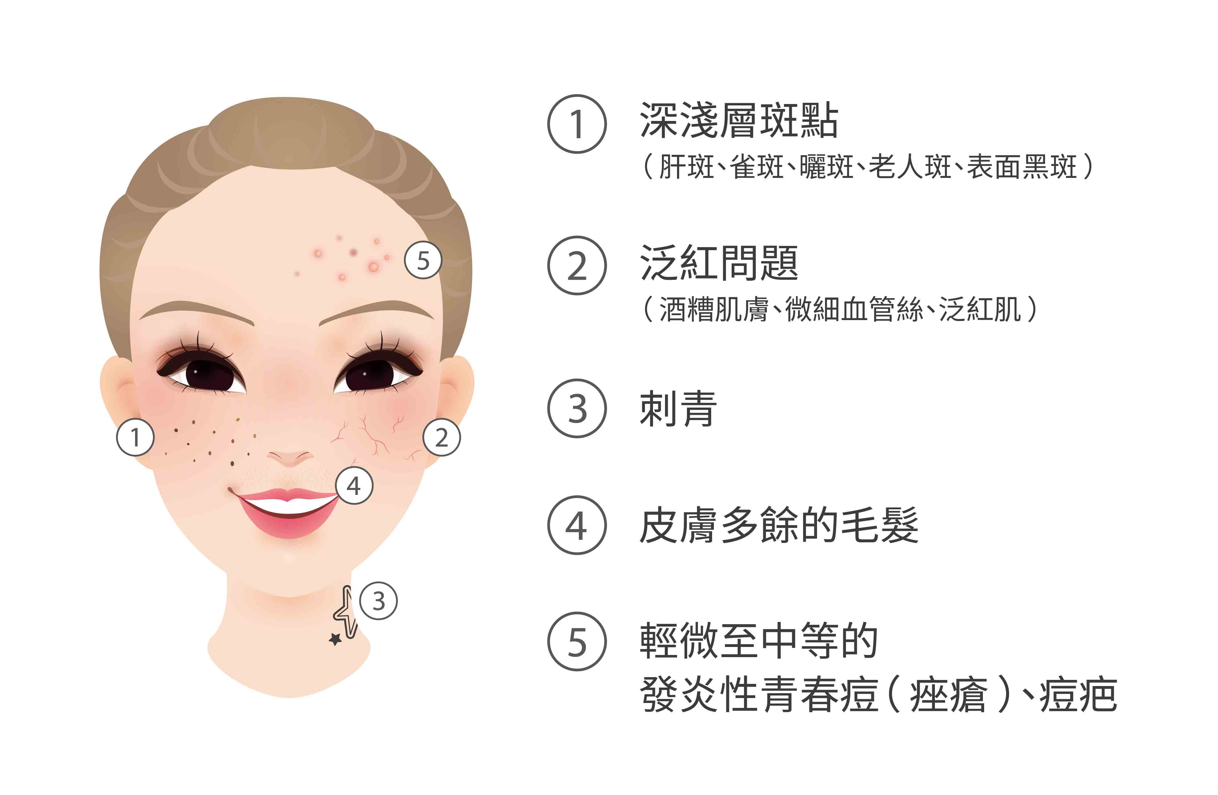 維納斯IPL 脈衝光是一種多功能的醫美技術，有感讓肌膚淨透亮白