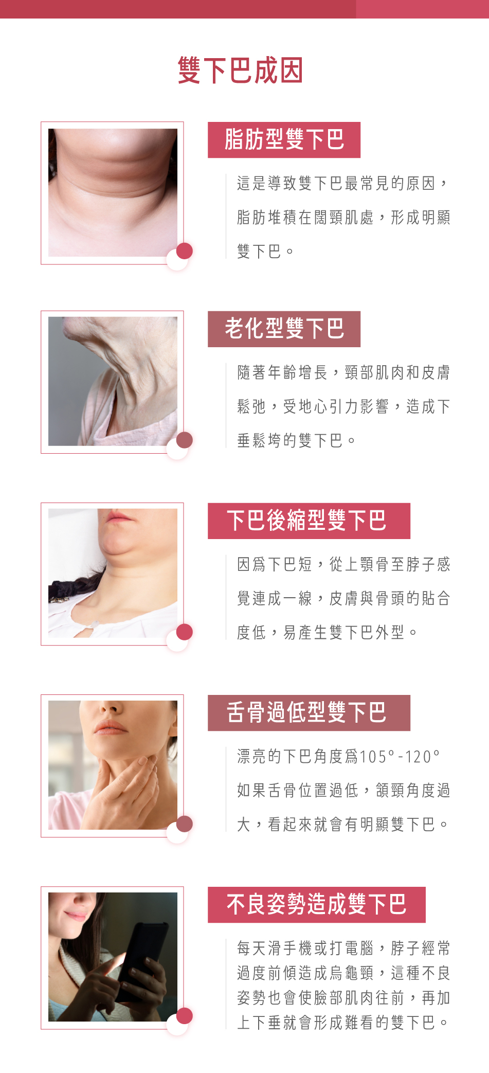 為什麼會形成雙下巴？怎麼分辨雙下巴成因