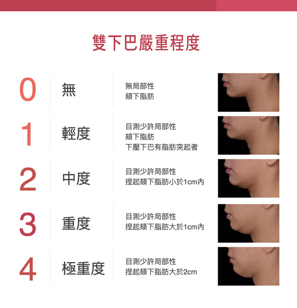 雙下巴症狀自我檢測