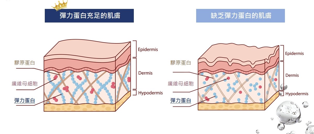 彈力蛋白