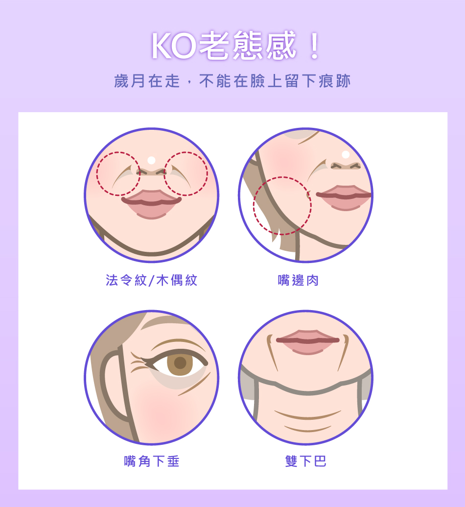 美特拉埋線拉提的效果