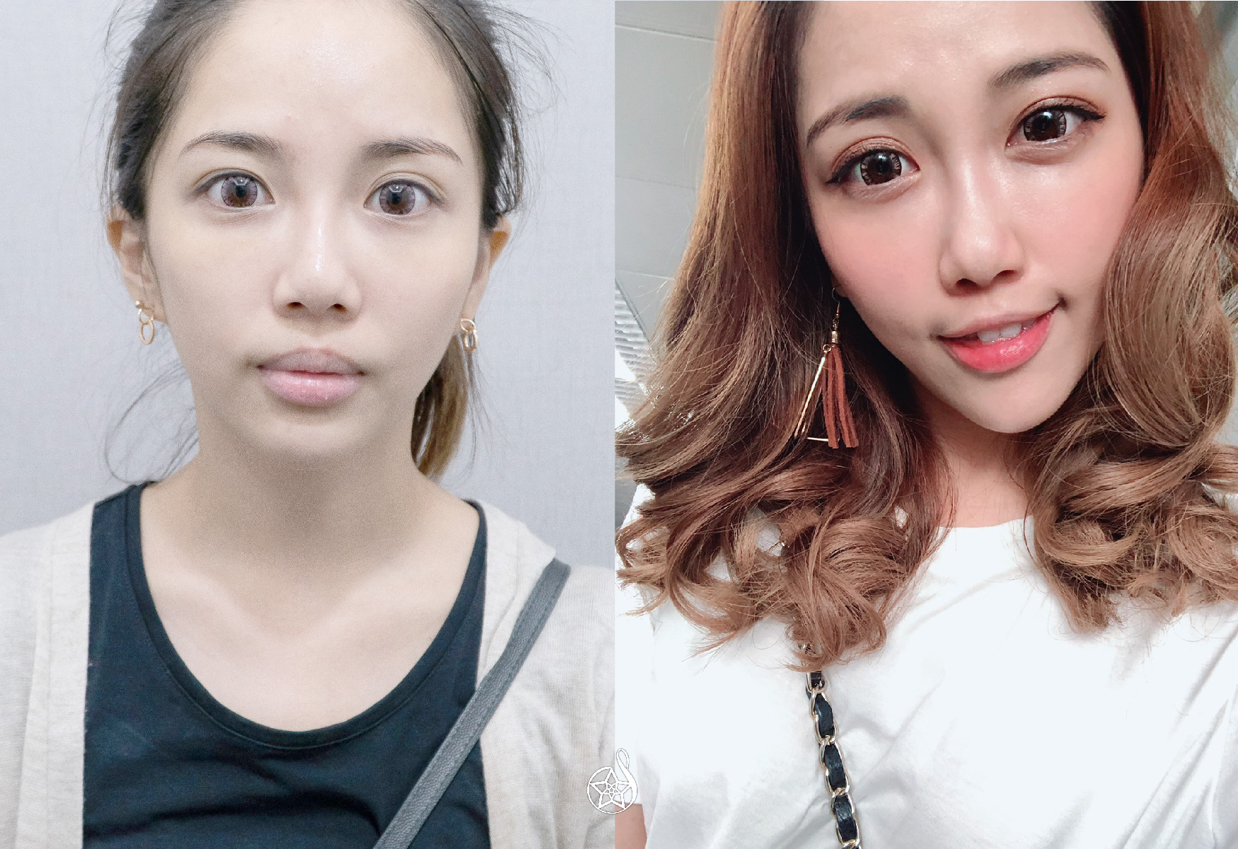 星和醫美 星采整形外科診所 星采皮膚專科診所 醫美診所推薦星醫美學