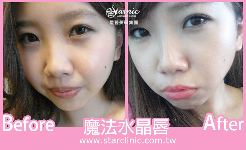 【星和愛美睫/魔法水晶唇】唇色暗沉不用怕!打造夢想粉嫩唇分享_ Phoebe