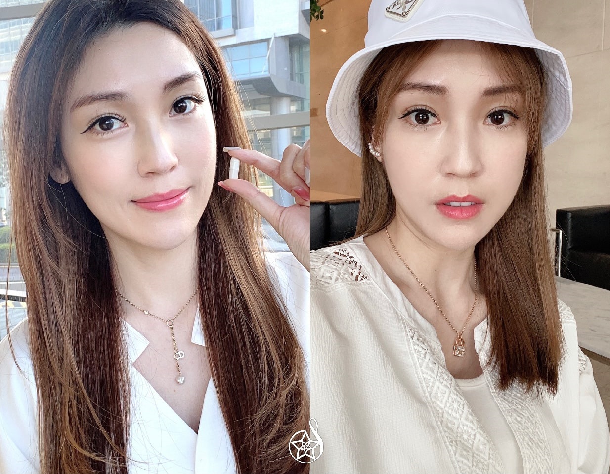 【玻尿酸】星和診所（新竹）-只要幾分鐘，就能擁有澎潤有朝氣的臉頰(下)-Serina甄詒