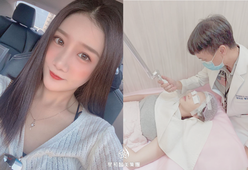 【淨膚雷射】