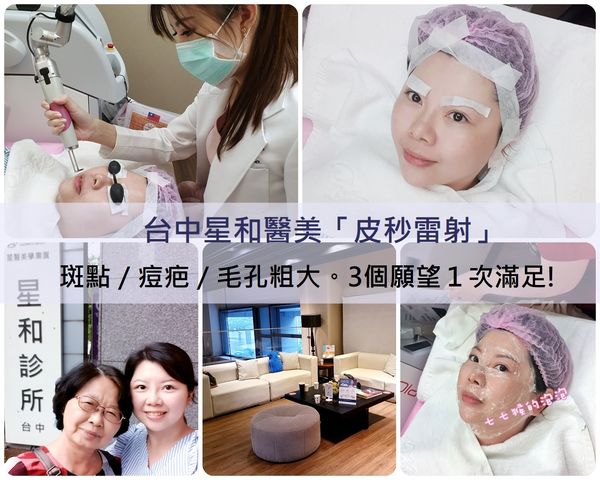 【皮秒雷射】星和診所/台中醫美-斑點/痘疤/毛孔粗大，3個願望1次滿足(上)-七七猴的泡泡
