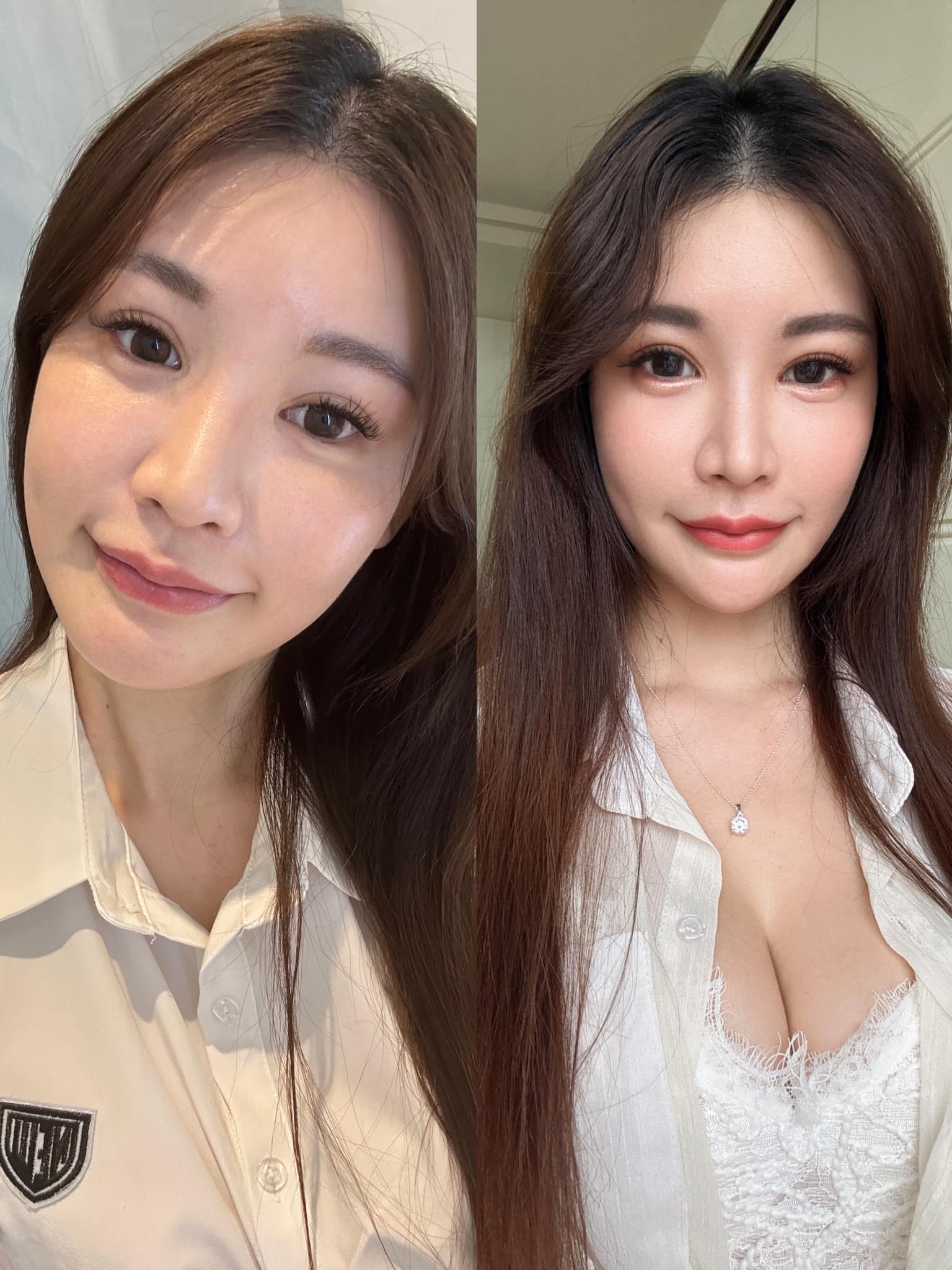 【玻尿酸】