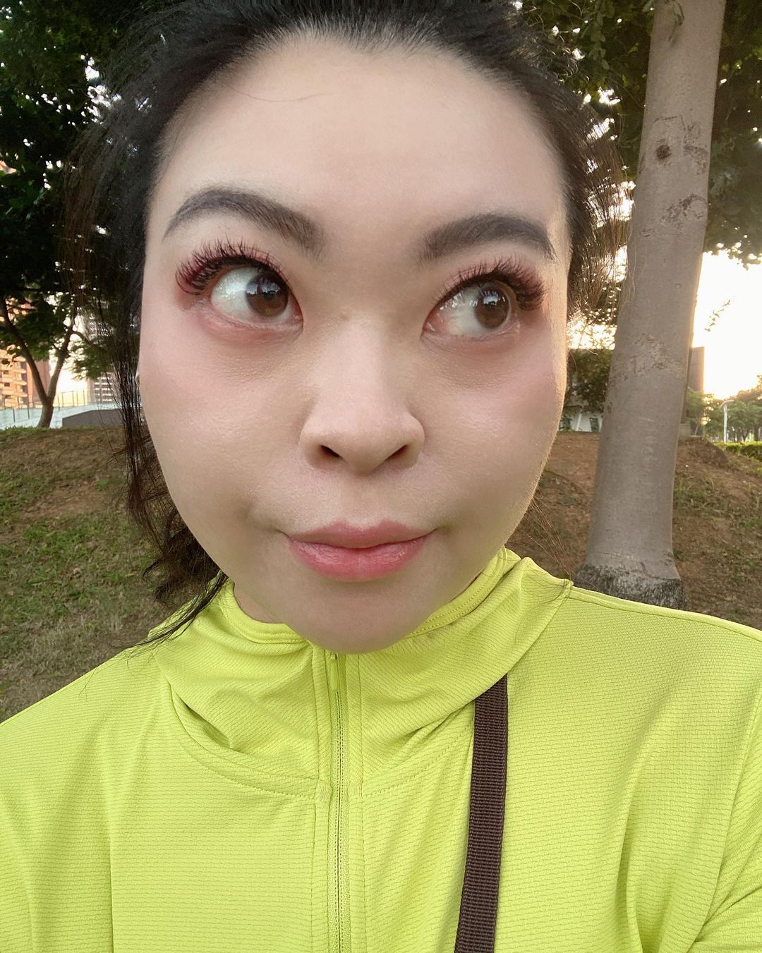 【肉毒除皺】