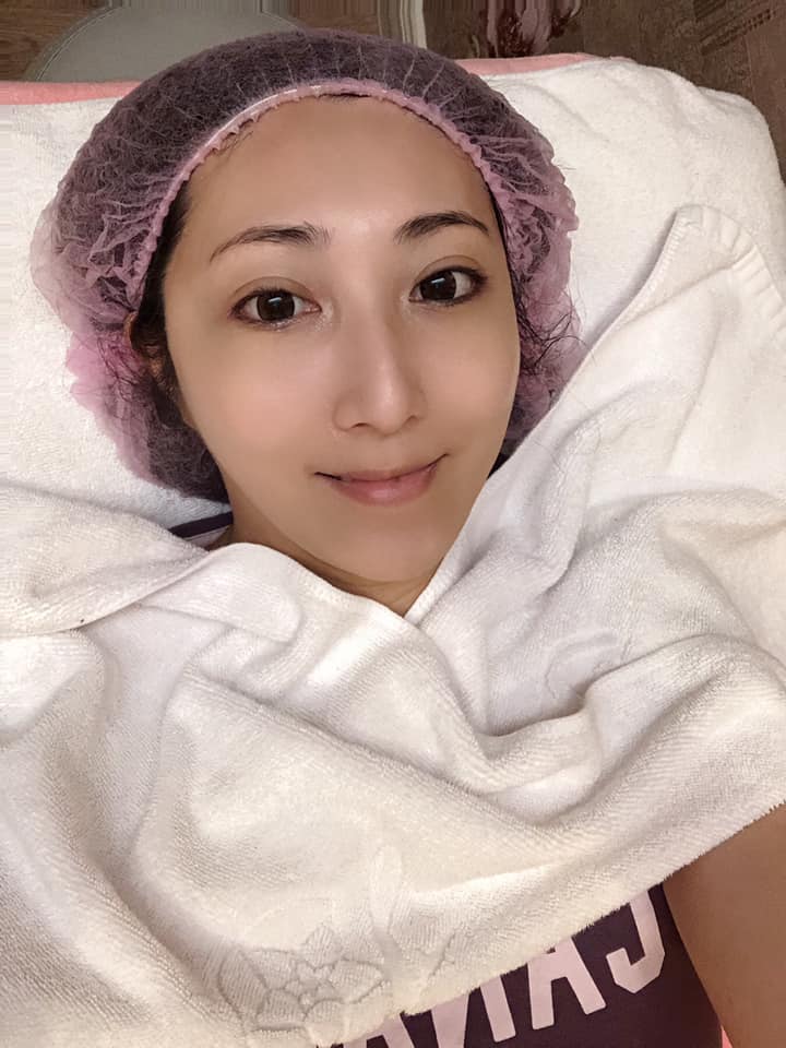 【杏仁酸煥膚】星采皮膚專科診所(古亭)-還我美麗又漂亮的肌膚-孫咪咪、Yui Huang(下)