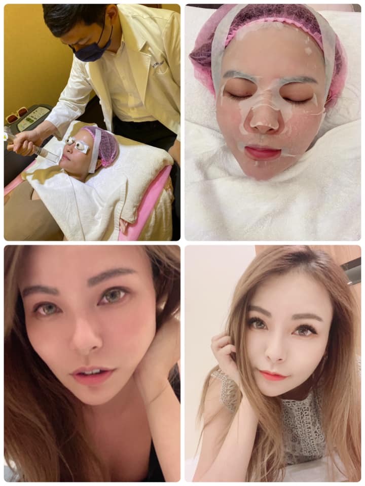 【淨膚雷射】星和診所/台南醫美-不僅臉蛋可以雷射保養，屁股蛋也能靠雷射美美的喔！(下)-優樹奈