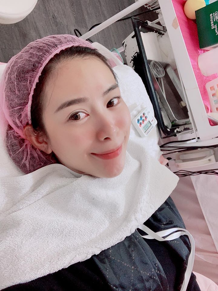 【杏仁酸煥膚】星和診所/北車醫美-煥膚後的肌膚讓人為之一亮-蘇雅甄、小青(上)