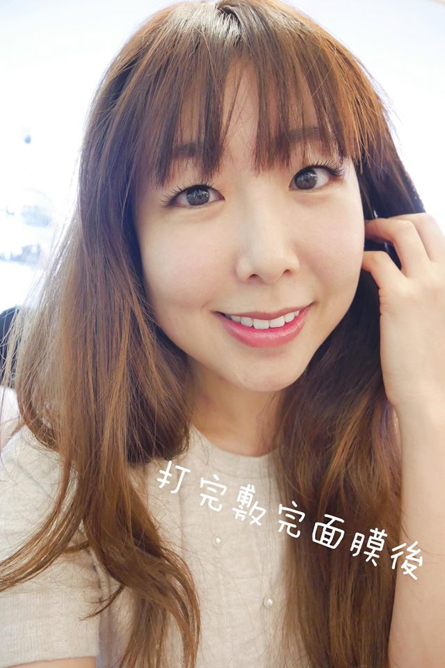 【電波拉提】仁愛星和診所/東區醫美-擁有緊緻Ｑ彈的肌膚不是問題-胖虎、C妞(下)
