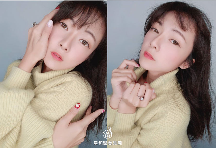 【杏仁酸煥膚】星和診所/台中醫美-讓自己變漂亮的小撇步- Abby Chen、藜兒(下)