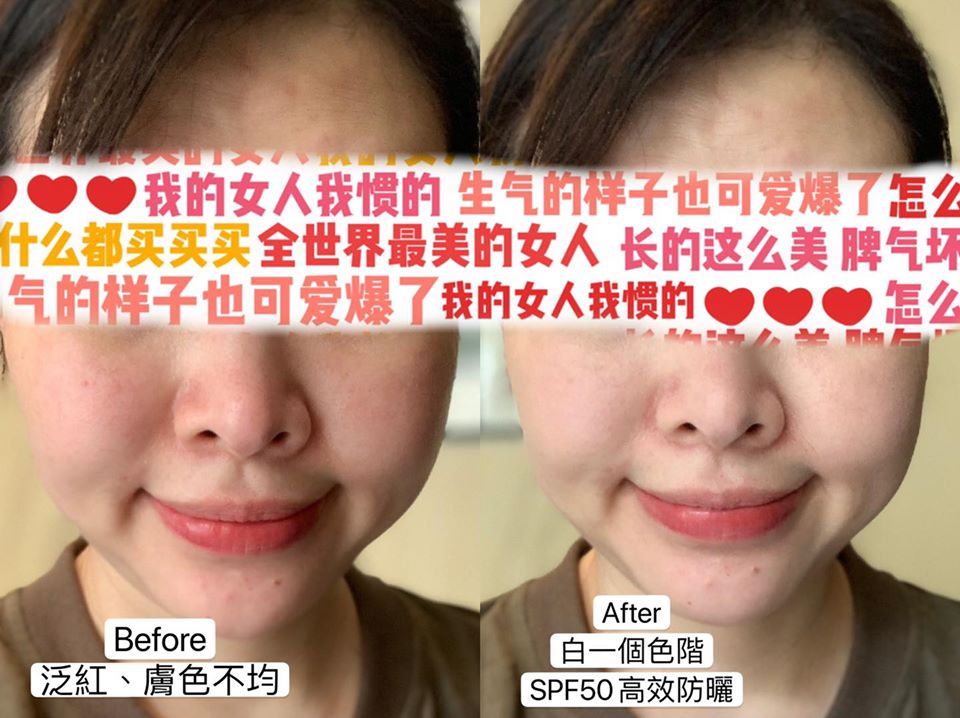 【活力滿點滴】星和診所/北車醫美-拒絕曬黑髒髒肌，呼朋引伴一起來活力滿點滴-桃李漫天下  、娃娃(下)