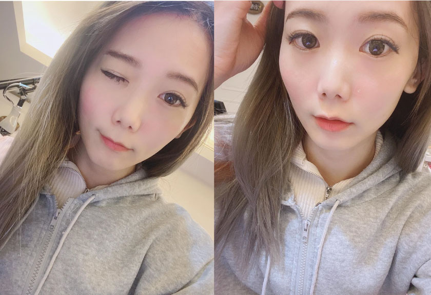 【飛梭雷射】